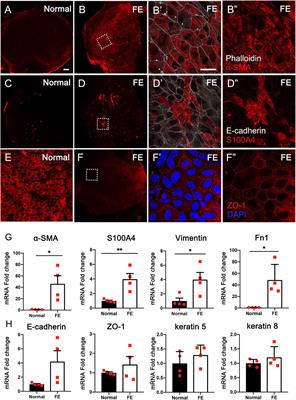 Epithelial–Mesenchymal Transition Participates in the Formation of Vestibular Flat Epithelium